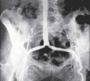 Főként az alsó végtag artériáinak műtéteit művelték az aorto-iliaco-femoropoplitealis érszakaszon (vénás és alloplasticus bypass