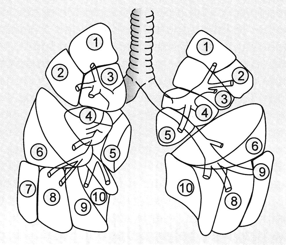 1. ábra A tüdő bronchopulmonalis szegmentumai elölről nézve (enyhén befelé fordított helyzetben) Bal oldal: 1) apicale, 2) posterior, 3) anterior, 4) laterale, 5) mediale, 6) basale superior