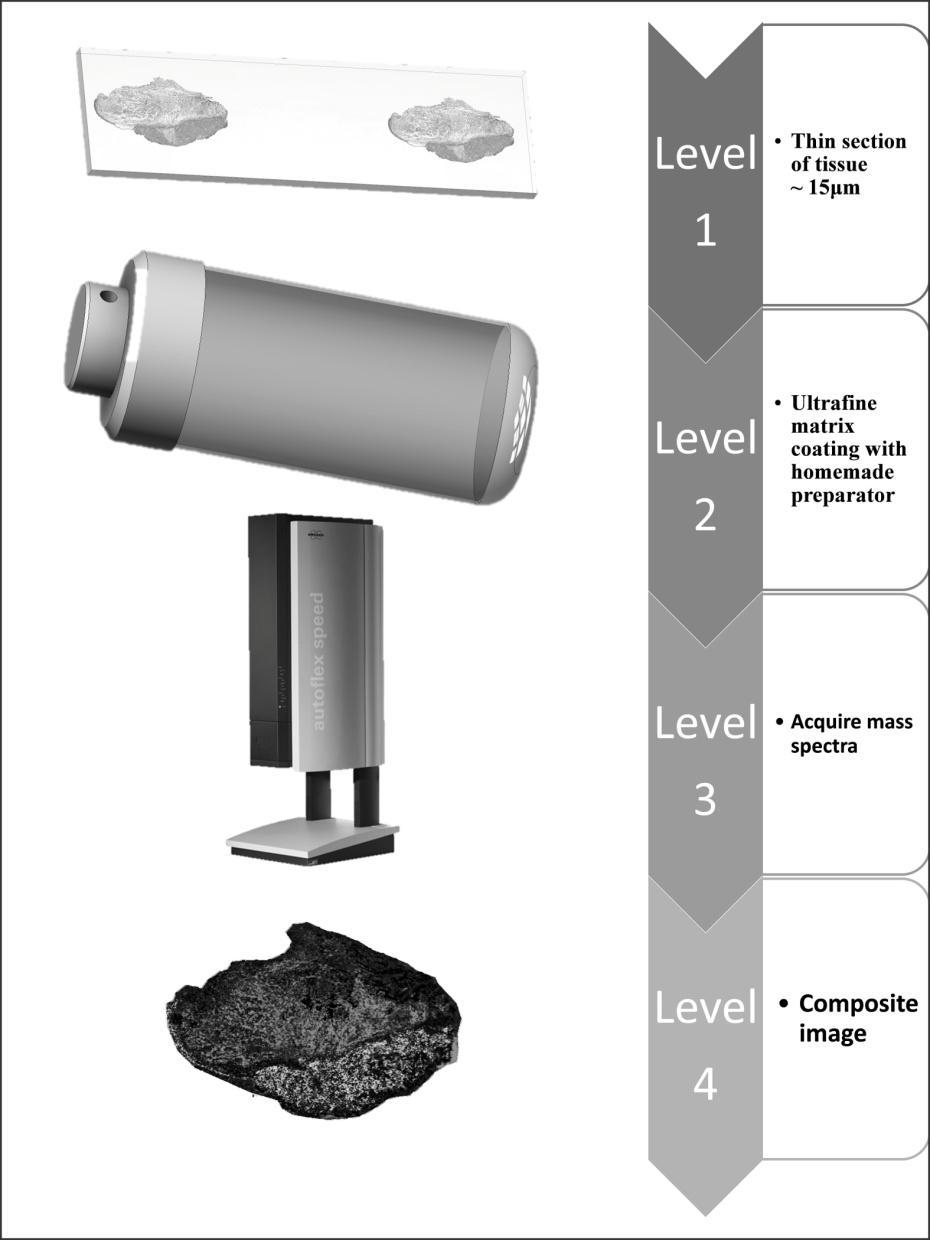 15 μm-es metszetek Porlasztott matrix MS felvétele Kompozit kép 2. ábra: Képalkotási tömegspektrometria folyama 4.5. Immunhisztokémia, konfokális mikroszkópia A sejtek morfológiai sajátságait