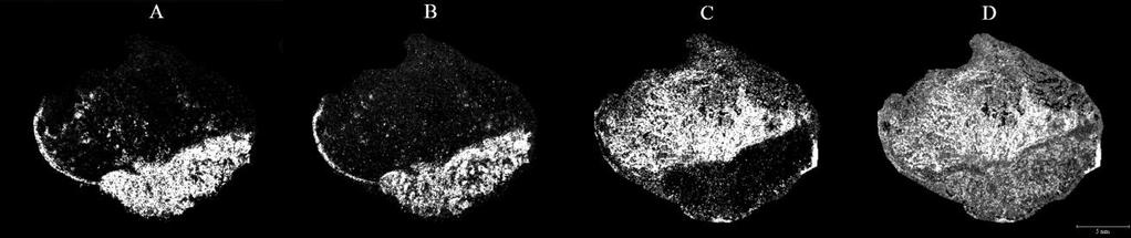 4. ábra: A vizsgált proteinek eloszlásai imaging MS segítségével a B2-es szövettani metszeteken. S100A8 (A), S100A9 (B), hemoglobin alfa lánc (C).