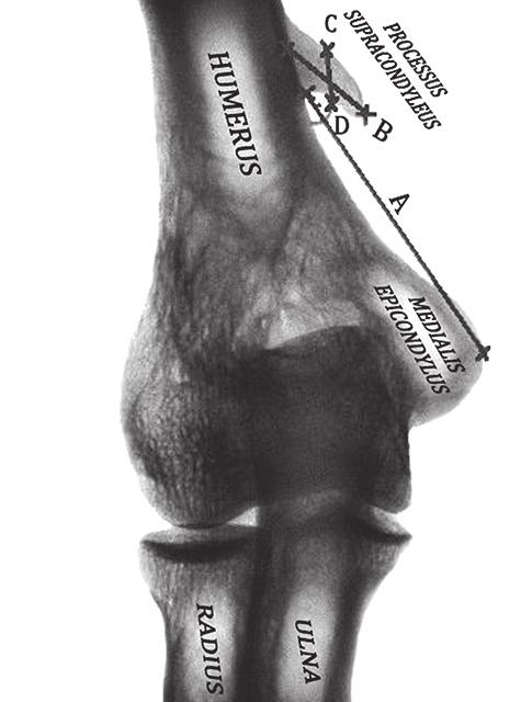 1. ábra. A processus supracondyleus paraméterei.