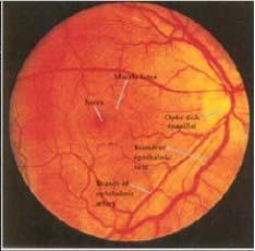 A retina (ideghártya) A legbelső