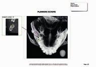 információkat nyújt az implantátum elhelyezéséhez, mely hatékonyan használható a diagnózis