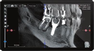 értékelése Orthodonciai kiértékelés elvégzése Gyulladásos kórképek