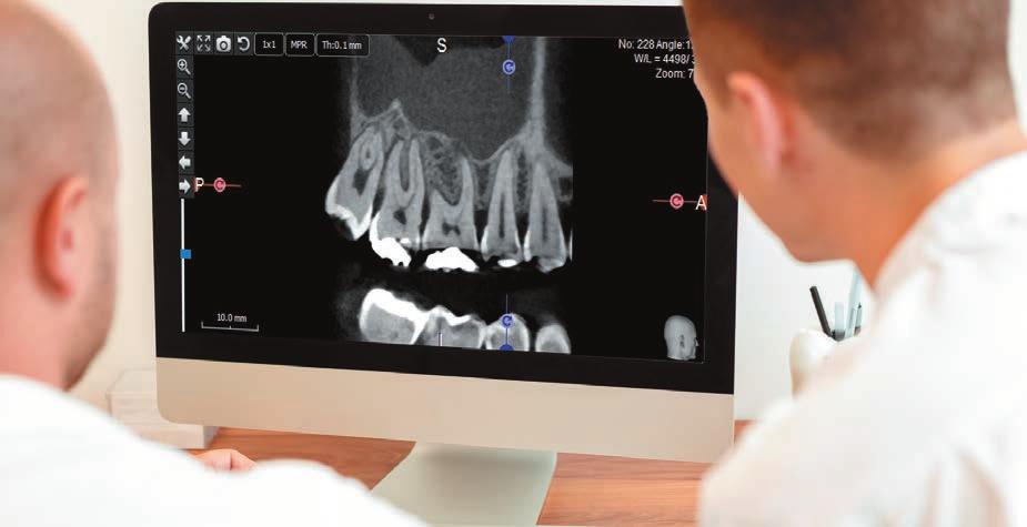 RENDKÍVÜLI KÉPMINŐSÉG NAGY FELBONTÁS 75 µm Az X-Mind Trium-mal készített 75 μm-es nagyfelbontású kép