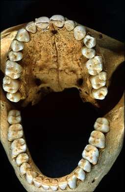 A maradó fogazat összesen 32, quaránsonkként 8-8 fogat tartalmaz. A fogképlete 2-1-2-3.