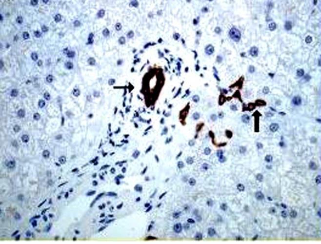 (kivéve máj) nincs, G0 sejtek újra osztódhatnak Máj - regeneráció (fokális, zonális necrosis) - ECM, BM károsodás (abscessus,