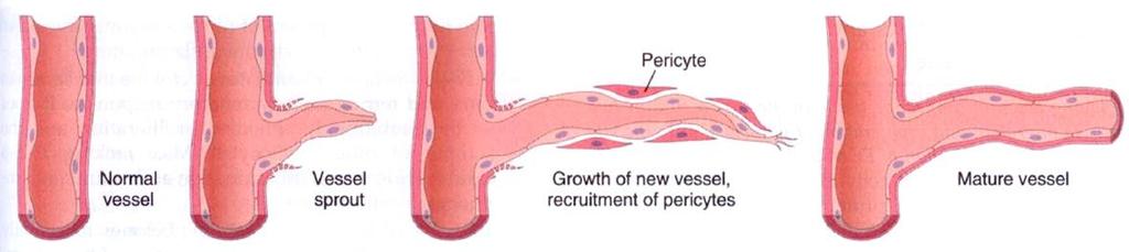 Angiogenezis Ér-újraképződés - Kezdete endotheliális sejt bimbózás ( sprouting ), proliferáció - Előrehalad a sebzés (hypoxia gradies) irányába, pericyta leválás - Az éretlen erek