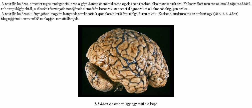 Mesterséges neurális hálózatok Források: Neurális Hálózatok a Mathematica felhasználásával - Dr. Paláncz Béla 2003 Mesterséges neurális hálózatok mint GIS függvények - dr.