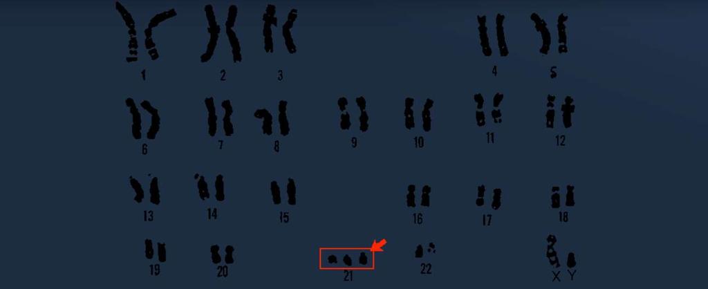 Tudja, hogy a kromoszómamutációk lehetnek szerkezetiek és számbeliek, hozzon ezekre példákat.
