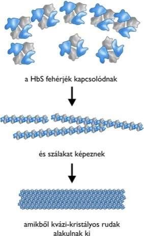 Sarlósejtes anémiában a vörösvértestek kóros hemoglobint tartalmaznak, melynek következtében egyes vörösvértestek sarló alakúvá válnak.