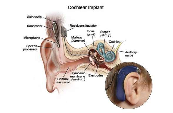 csontvezetéssel juttatják a belső fülbe.