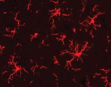 IBA-1 festett microglia