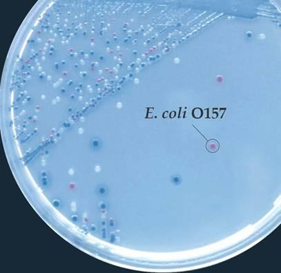 Bakteriológiai tenyésztés általános rutin vizsgálatok, minimális panel: Salmonella spp., Shigella spp.