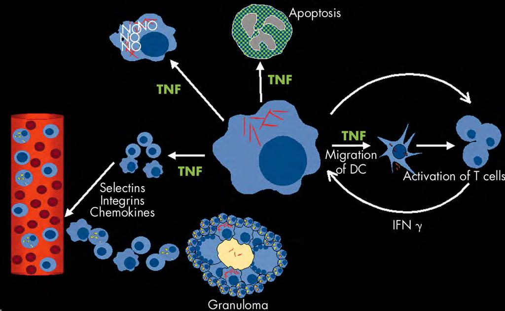 TNF szerepe a TBC baktérium elleni védekezésben granuloma képződés -a szervezet mycobactérum elleni védekezésének része -TNF mediálja
