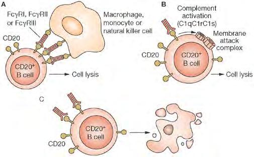 A rituximab hatásmechanizmusa CD20 + sejtek depléciója Dalakas MC (2008) B cells as