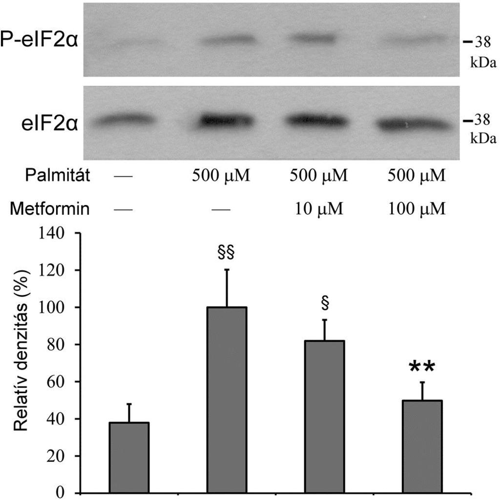 58. ábra Az eif2α foszforilációja lipotoxicitásban [Simon-Szabó et al., 2014] A patkány inzulinóma sejteket palmitáttal (500 µm) és/vagy metforminnal (10 µm, 100 µm) kezeltük.