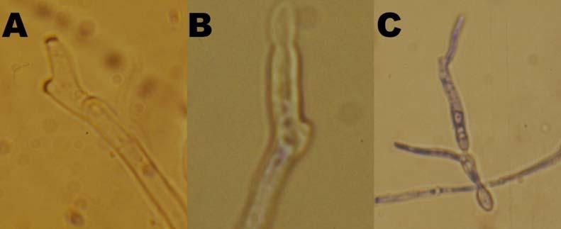 proliferálódott konídiumképz sejtje (A), holoblasztikusan kifúvódó