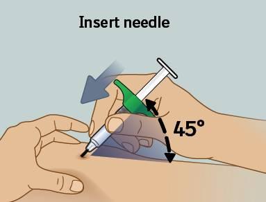7) Csippentse össze a bőrét Csippentse össze a bőrét az injekció beadási helye körülés tartsa meg így Óvatosan csippentse össze bőrét a megtisztított beadási hely