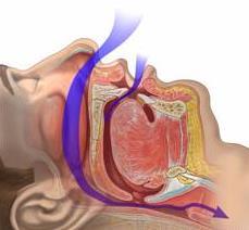 breathing disorders (SRBD)