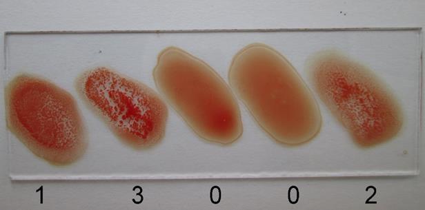 5. táblázat: A hemagglutinációs próba eredményének összefoglaló táblázata hemagglutináló törzsek aránya (%) vértípus B. avium O.