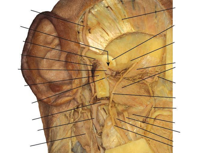 170 OBERNA ÉS MTSAI a a. carotis interna fossa cranii media fossa mandibularis m. temporalis os temporale discus articularis caput mandibulae m.