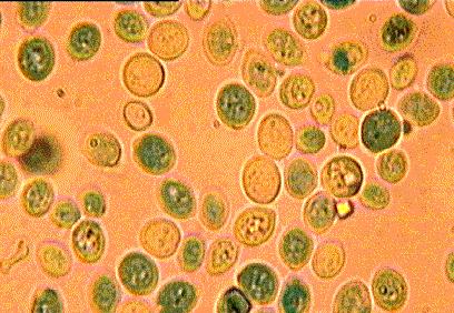 Az így kezelt anyagból készítsünk új preparátumot! Az élő sejtek színtelenek maradnak, az elölt élesztősejtek viszont metilénkékkel jól festődnek, a mikroszkópban részletgazdagabb képet adnak.