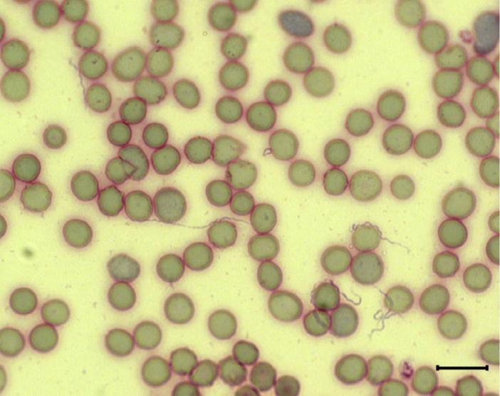 6. ábra: Giemsa-festett perifériás vérkenet a B. miyamotoi LB-2001-el fertőzött SCID egérből. Méretarány: 10 µm. (Wagemakers és mtsai.