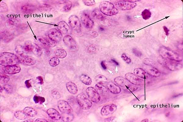 Mitotikus aktivitás a cryptakban mitotikus sejt: kondenzált kromoszómák intenzív