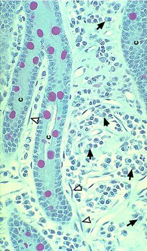 A bél immunrendszere: GALT Gut Associated Lymphoid Tissue: a