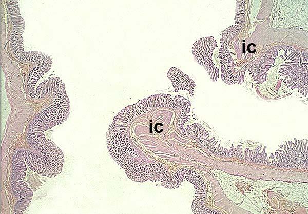 Ileo cecalis bemenet colon ascendens ileum cecum ileumban villusok ileocecalis billentyű (ic) visszaáramlás