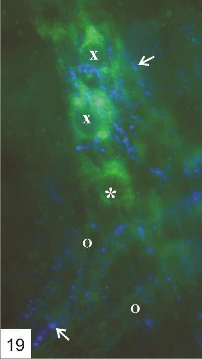 ábra NOS/NMDA receptor NR1 alegység kettős fluoreszcens immunfestés humán magzati vékonybélből készített wholemount preparátumon.