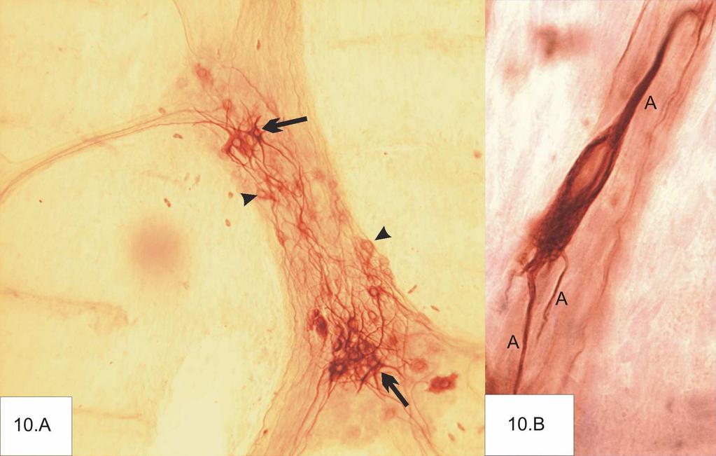 sejtméret alapján az NF-pozitív idegsejtek két csoportot képeztek. A nagyobb sejttesttel rendelkezők perikarion területe átlagosan 350 µm 2, a kisebbeké 170 µm 2 volt. 10.