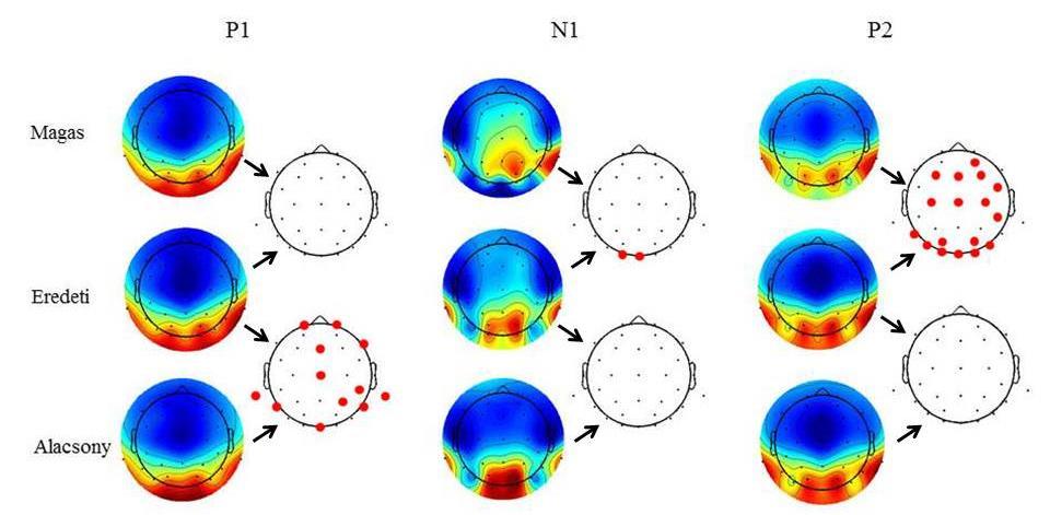 N1 P1 P2 3. ábra: Az ábra az Oz elektródán regisztrált eseményfüggő potenciálokat mutatja eredeti, ATF, illetve MTF képek esetén.