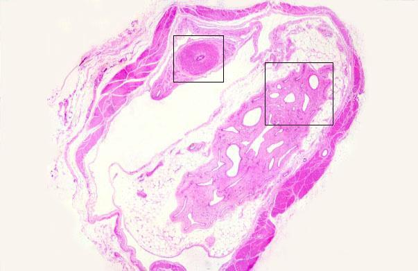 Funiculus spermaticus - ondózsinór Tartalma: 1. Ductus deferens 2. Art., véna ductus deferentis 3. Artéria testicularis 4.