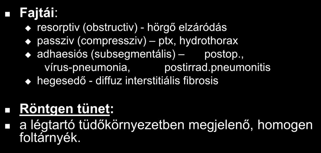 Atelectasia Fajtái: resorptiv (obstructiv) - hörgő elzáródás passziv (compressziv) ptx, hydrothorax adhaesiós (subsegmentális) postop.