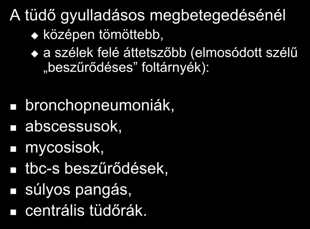 Beszűrődéses árnyékok A tüdő gyulladásos megbetegedésénél