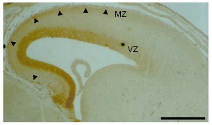 4. Ábra Az EMX2 fehérje a fejlődő (E14; egér) előagyi kéreg germinatív rétegében (VZ) és a marginális zóna (MZ) sejtjeiben fejeződik ki (barna festődés).