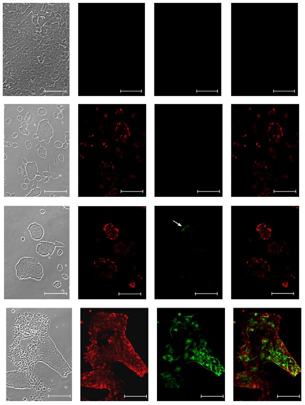 POSZTMITÓTIKUS NEURON ELŐALAKOK MEGJELENÉSE Az első béta-iii-tubulin immunreaktív neuronok a harmadik (aggregációs) stádiumban, az aggregátumokon belül, az RC2 pozitív sejtek megjelenését követően