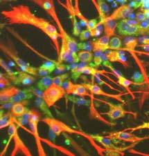 Ábra A TSPO gén kifejeződése az NE-4C sejtek idegi differenciálódása során Az indukálatlan idegi őssejtek és a harmadik stádiumban megjelenő morfológiailag éretlen, de béta-iii-tubulin pozitív idegi