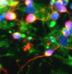 Kettős immuncitokémiai eljárással nyert adataink azt mutatták, hogy az indukálatlan NE- 4C sejtek, fiatal neuron előalakok, valamint az asztrociták tartalmazzák a TSPO fehérjét.