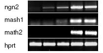 Az in vitro kifejlődött idegsejteket βiii-tubulin festődés alapján azonosítottuk a 7 napos NE-4C, a 15 napos R1 (ES), illetve a 4 napos P19 (EC) tenyészetekben. Mérték: 50 μm. B.