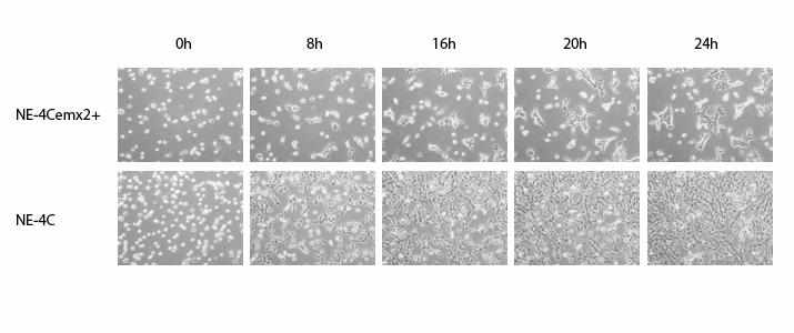 EMX2 MEGVÁLTOZTATJA AZ IDEGI ŐSSEJTEK ADHÉZIÓS TULAJDONSÁGAIT, MÓDOSÍTJA CADHERIN MOLEKULA KÉSZLETÜKET Az NE-4C emx2+ sejtek osztódása eredményeképpen kialakult sejt csoportokban a sejtek szorosan
