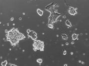 A tenyészetektől a sejtek kitapadása után (sejt sűrűség 20000 sejt/ cm2) megvontam a mitótikus faktorokat.