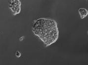 Az NE-4C emx2+ sejtek ezzel szemben 12 óra alatt kompakt aggregátumokká szerveződtek, amelyek emlékeztetnek az NE-4C sejtek RA-indukált differenciálódásának