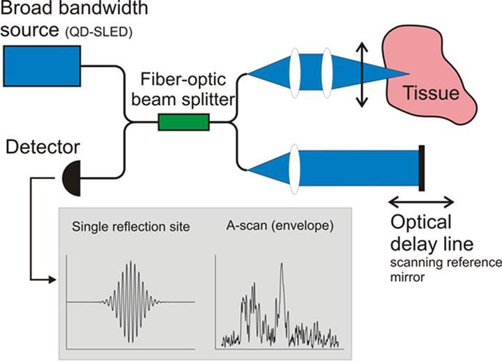 A koherencia tomográfia elve (a laser fényt ketté osztjuka mintáról visszavert és az