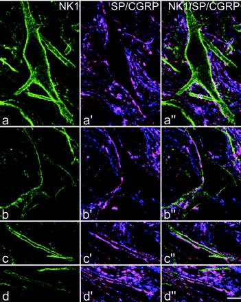 Neuropeptid receptor-ligand komplex internalizációja gyakorlati jelentőség Confocal images showing contacts from substance P primary afferents onto the cell bodies and dendrites of the two NK1