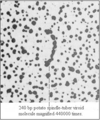 A prion betegségre jellemző: nincs ellenanyag termelés, nincs gyulladásos reakció, a lappangási idő évekig tarthat, jelentős idegsejt pusztulás jellemző. Prion okozta kórképek.