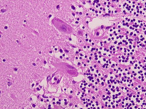 Purkinje sejtek rétege: str gangliosum: Purkinje sejtek sejttestje Szemcsés réteg:str granulosum kis gömb alakú sejtek.