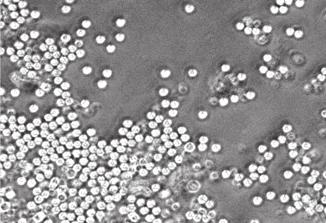 Immobilizált immunkomplex-felszínen a vad típusú egér neutrofilekkel szemben az FcR -hiányos sejtek képtelenek voltak szuperoxid-termelésre (35. ábra A-B része).